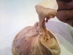 黏度高