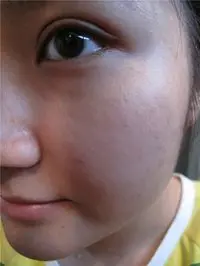 chun2a